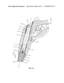 SURGICAL IMPLANT SYSTEM AND METHOD diagram and image