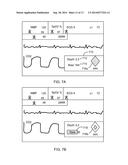 SHOCK DETERMINATION BASED ON PRIOR SHOCKS diagram and image