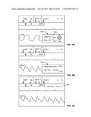 WINDOWING FOR IDENTIFYING SHOCK OUTCOME diagram and image