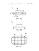 EXTERNALLY-SECURED MEDICAL DEVICE diagram and image