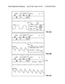 TREATMENT GUIDANCE BASED ON VICTIM CIRCULATORY STATUS AND PRIOR SHOCK     OUTCOME diagram and image