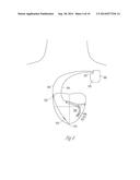 PACING AND SENSING VECTORS diagram and image