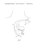 PACING AND SENSING VECTORS diagram and image