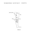 DEVICE AND METHODS FOR PREVENTING KNEE SPRAIN INJURIES diagram and image