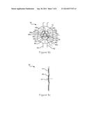 PROSTHESIS HAVING AN EVERTING PIVOTING FENESTRATION diagram and image