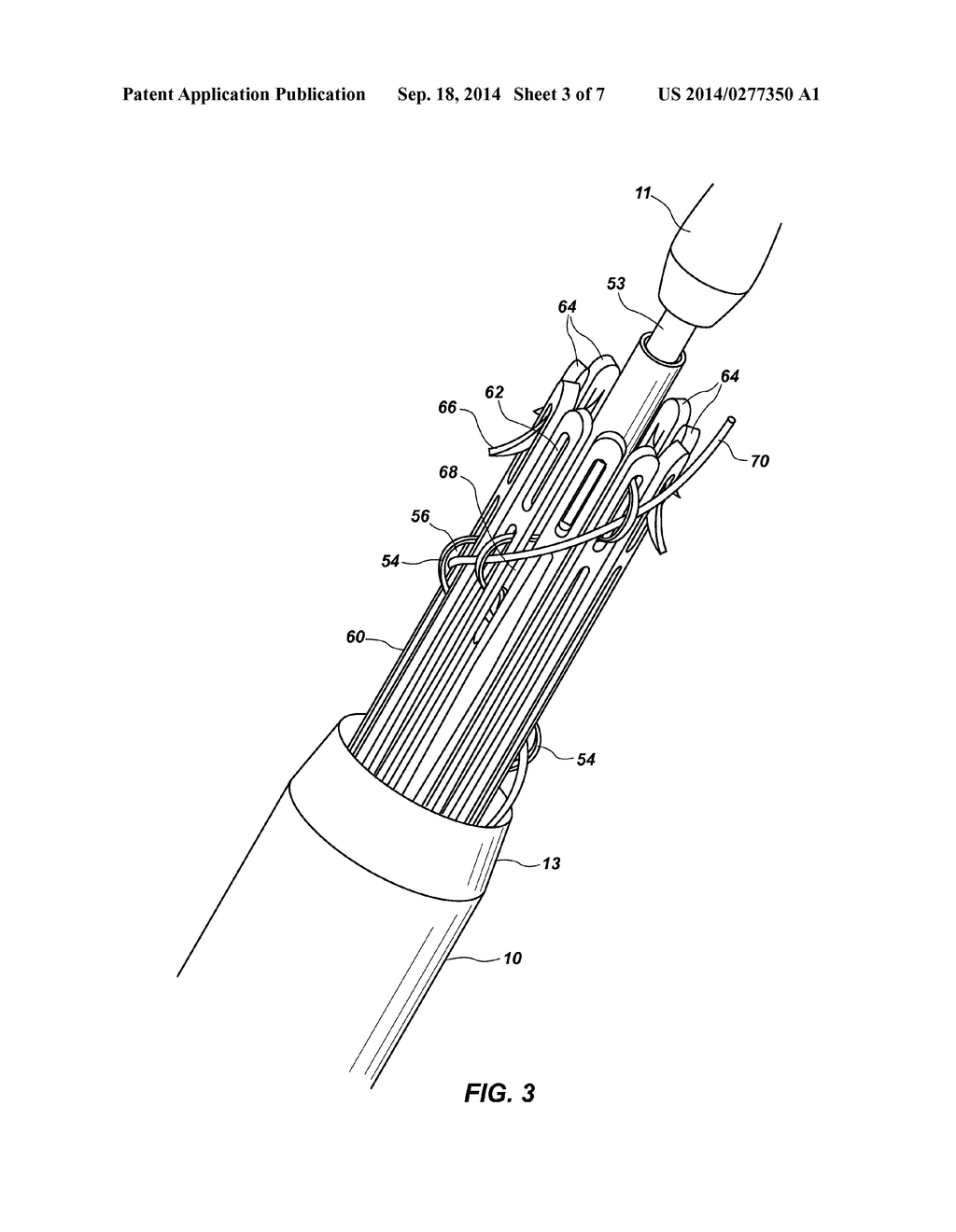 IMPLANT INTRODUCER WITH HELICAL TRIGGER WIRE - diagram, schematic, and image 04