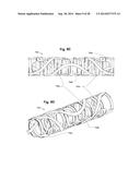 REDUCED-PROFILE SLIDE AND LOCK STENT diagram and image