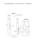 REDUCED-PROFILE SLIDE AND LOCK STENT diagram and image