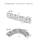 REDUCED-PROFILE SLIDE AND LOCK STENT diagram and image