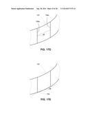 REDUCED-PROFILE SLIDE AND LOCK STENT diagram and image