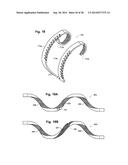 REDUCED-PROFILE SLIDE AND LOCK STENT diagram and image