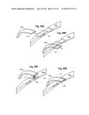 REDUCED-PROFILE SLIDE AND LOCK STENT diagram and image