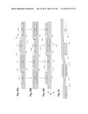 REDUCED-PROFILE SLIDE AND LOCK STENT diagram and image