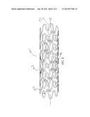 EXPANDABLE STENT HAVING A CONSTANT LENGTH diagram and image