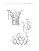 RADIOPAQUE TRANSCATHETER VALVE AND ANATOMICAL MARKERS diagram and image