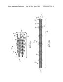 STENT AND METHOD OF USE diagram and image