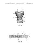 Devices and Methods for Preparing A Transcatheter Heart Valve System diagram and image