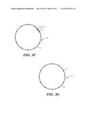 CUFF CONFIGURATIONS FOR PROSTHETIC HEART VALVE diagram and image