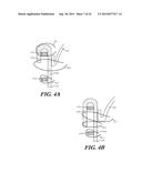 CUFF CONFIGURATIONS FOR PROSTHETIC HEART VALVE diagram and image