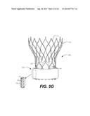 CUFF CONFIGURATIONS FOR PROSTHETIC HEART VALVE diagram and image