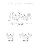 CUFF CONFIGURATIONS FOR PROSTHETIC HEART VALVE diagram and image