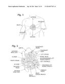 DYNAMIC ANNULOPLASTY RING SIZER diagram and image