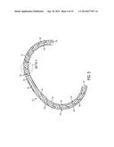 DYNAMIC ANNULOPLASTY RING SIZER diagram and image