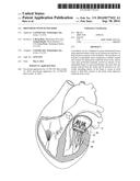 PROSTHESIS WITH OUTER SKIRT diagram and image