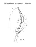 PROSTHESIS WITH OUTER SKIRT diagram and image