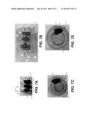 PARAVALVULAR LEAK OCCLUSION DEVICE FOR SELF-EXPANDING HEART VALVES diagram and image