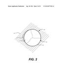 Paravalvular Leak Occlusion Device for Self-Expanding Heart Valves diagram and image