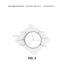 Paravalvular Leak Occlusion Device for Self-Expanding Heart Valves diagram and image