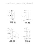 Paravalvular Leak Occlusion Device for Self-Expanding Heart Valves diagram and image