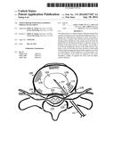 Tissue Repair with Space-Seeking Spirals of Filament diagram and image