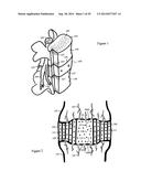 Tissue Repair with Space-Seeking Spirals of Filament diagram and image