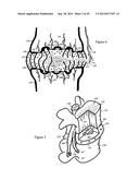 Tissue Repair with Space-Seeking Spirals of Filament diagram and image