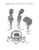 Tissue Repair with Space-Seeking Spirals of Filament diagram and image