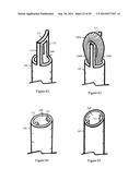 Tissue Repair with Space-Seeking Spirals of Filament diagram and image