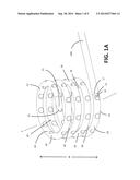 EXPANDABLE COIL SPINAL IMPLANT diagram and image