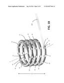 EXPANDABLE COIL SPINAL IMPLANT diagram and image