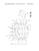 EXPANDABLE COIL SPINAL IMPLANT diagram and image