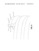 EXPANDABLE COIL SPINAL IMPLANT diagram and image