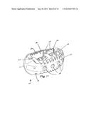 VERTEBRAL BODY REPLACEMENT AND METHOD OF USE diagram and image