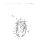 VERTEBRAL BODY REPLACEMENT AND METHOD OF USE diagram and image