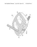 Bone Fusion Implant Device diagram and image