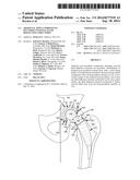 ARTIFICIAL JOINT COMPONENTS INCLUDING SYNOVIAL FLUID DEFLECTING STRUCTURES diagram and image