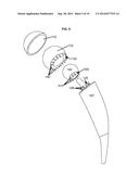 ARTIFICIAL JOINT COMPONENTS INCLUDING SYNOVIAL FLUID DEFLECTING STRUCTURES diagram and image