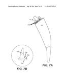 ARTIFICIAL JOINT COMPONENTS INCLUDING SYNOVIAL FLUID DEFLECTING STRUCTURES diagram and image