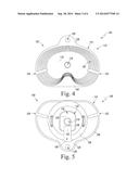 TIBIAL IMPACTION GUIDE SURGICAL INSTRUMENT AND METHOD OF USING SAME diagram and image