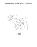 METHOD FOR IMPLANTING A HIP PROSTHESIS AND RELATED SYSTEM diagram and image